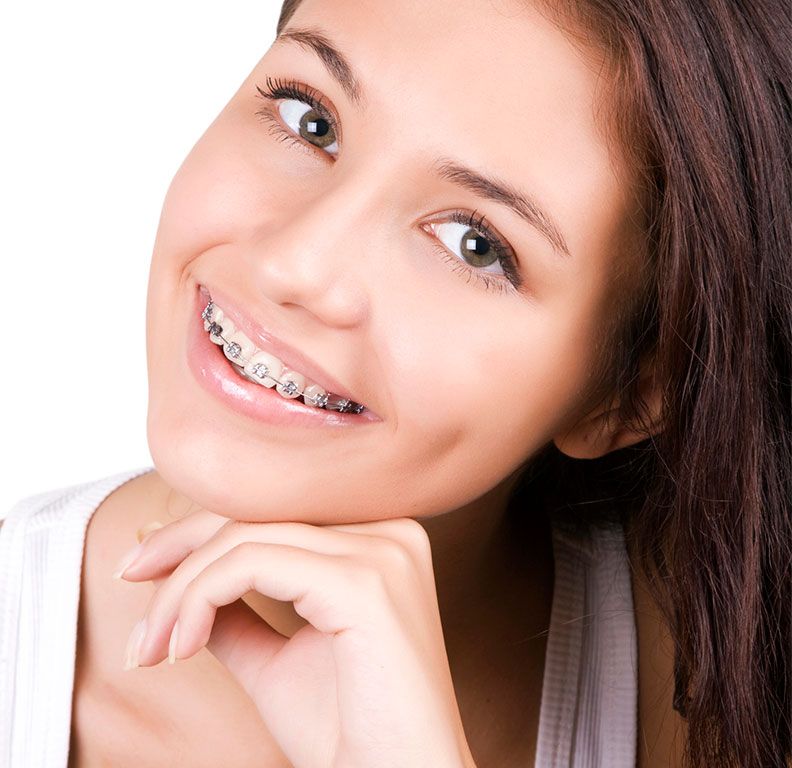 Clínicas Reydental - Braquets convencionales