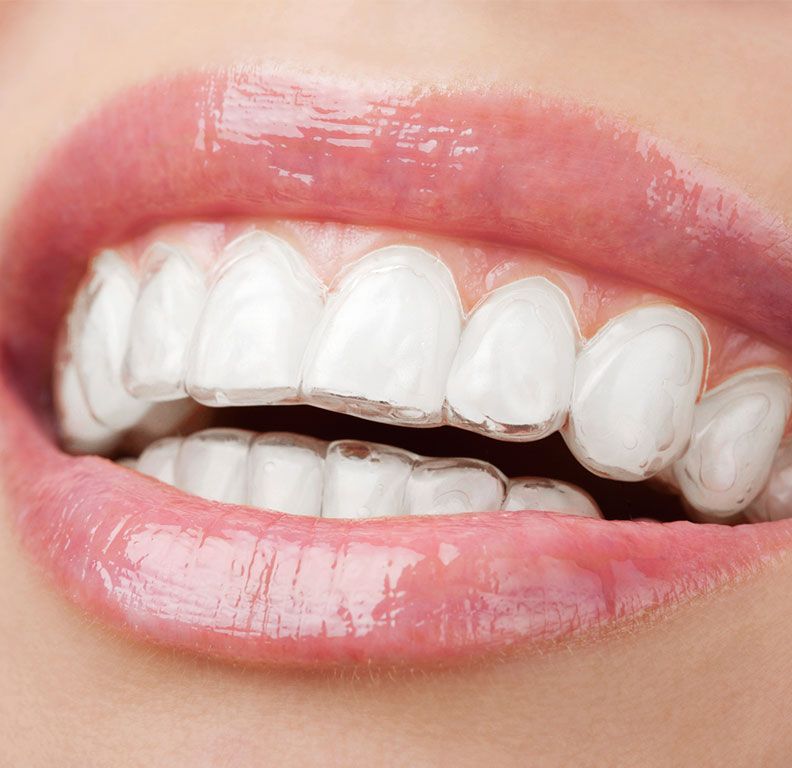 Clínicas Reydental - Invisalign